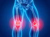Rodilla