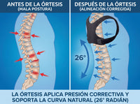 Corrector de Postura Ajustable — Alivio para cuello y espalda