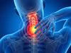 Cuello